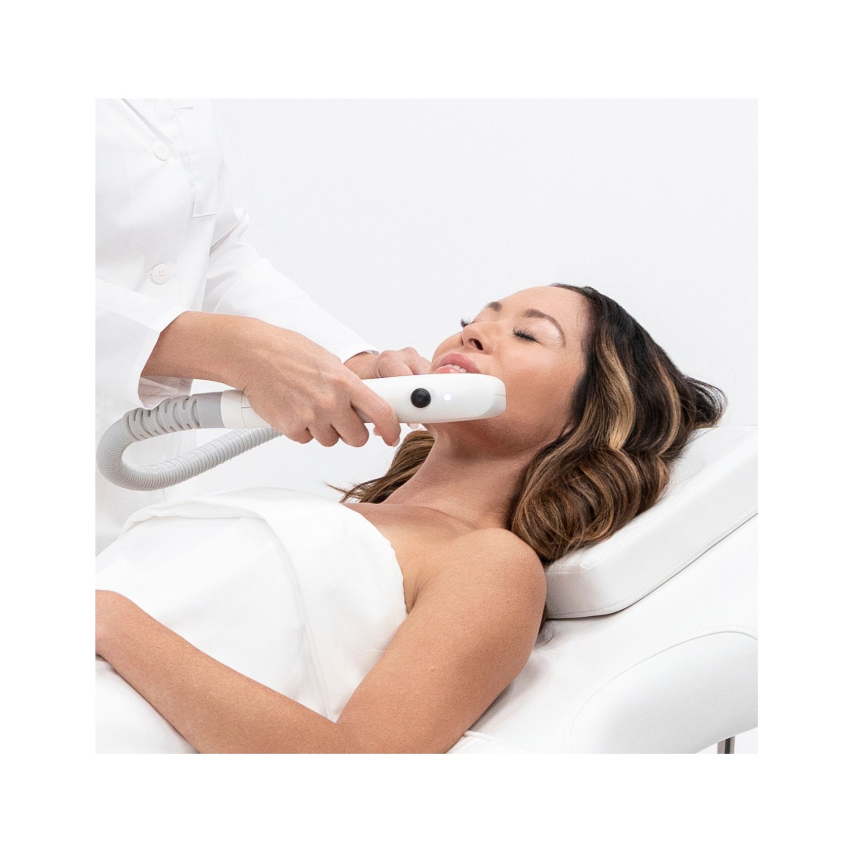 Sofwave Acne Scars Treatment