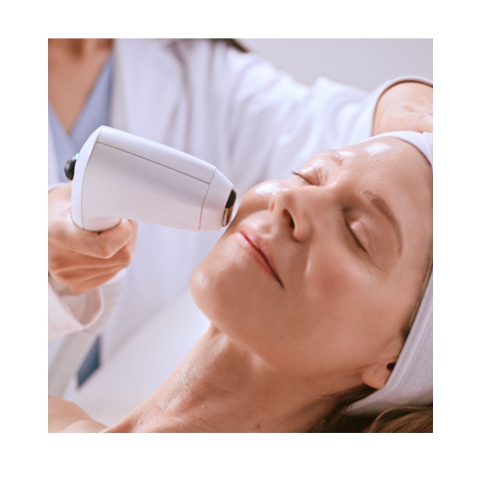 Prevalence & Concern of Acne Scarring