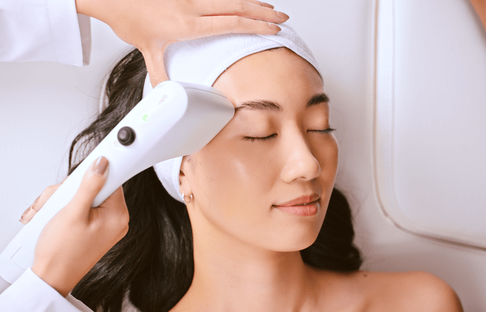 Eyebrow Lifting with Sofwave