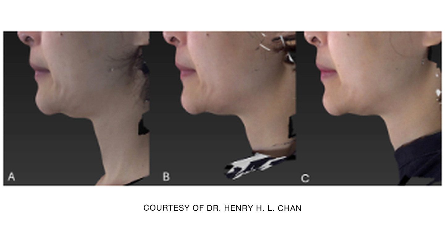 Courtesy of Dr. Henry H. L. Chan